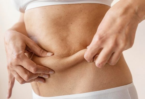 Fat Burning (Yağ Yakıcı) Terapi