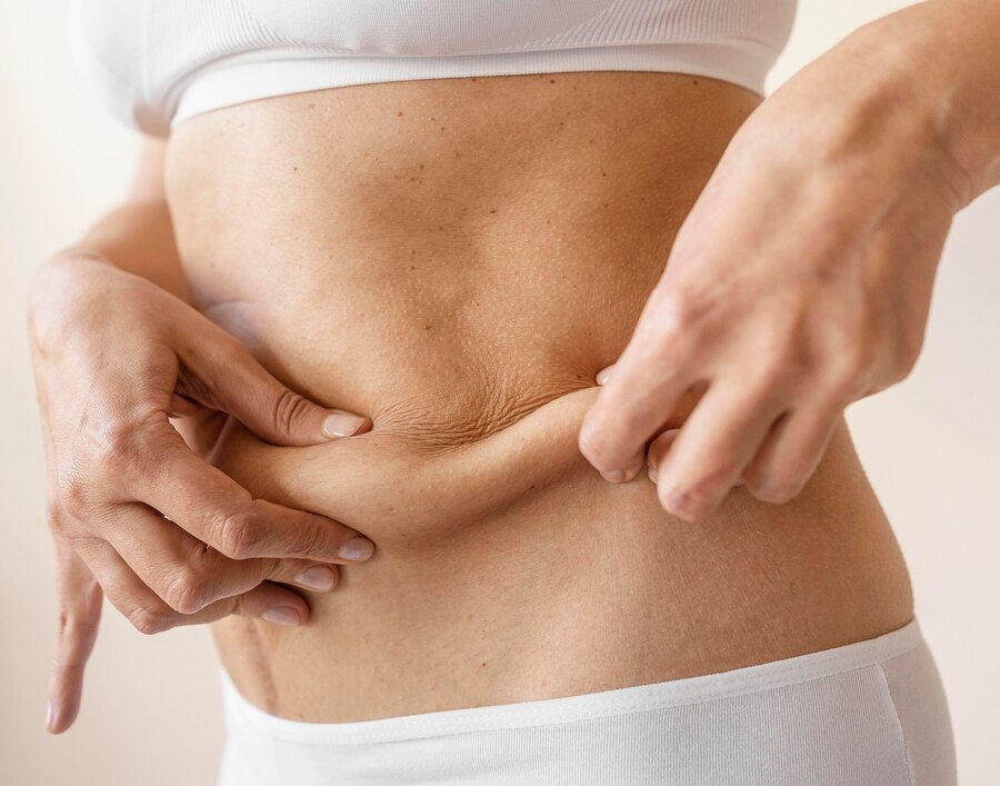 Fat Burning